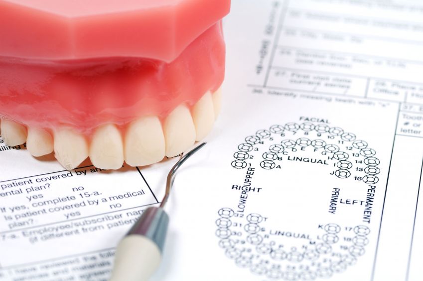 Learn More About Implant Dentistry And Its Advantages