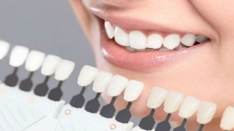 Finding An Expert For Teeth Implants in Macon, GA