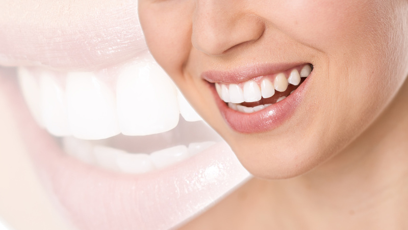 Everything You Need to Know About Orthodontic Treatment in Vancouver, WA