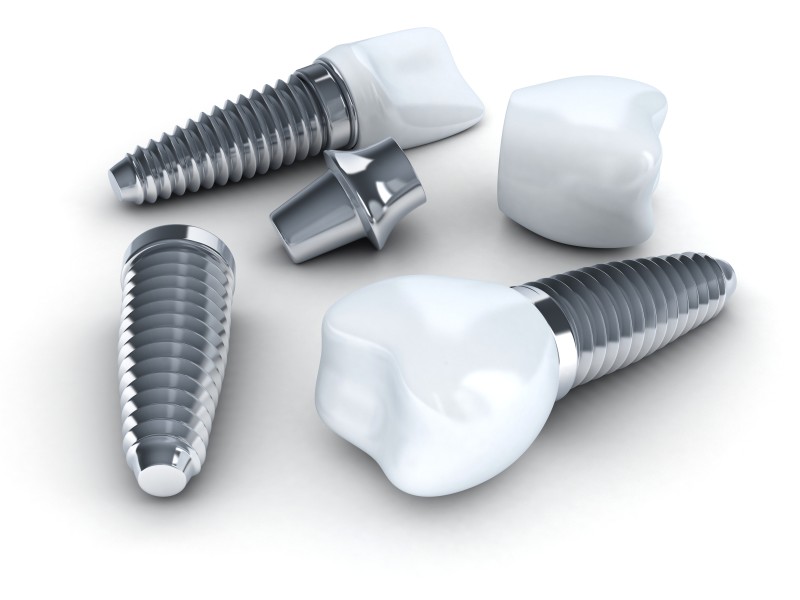 2 Situations That Call for Help From an Emergency Dentist in Lakeview