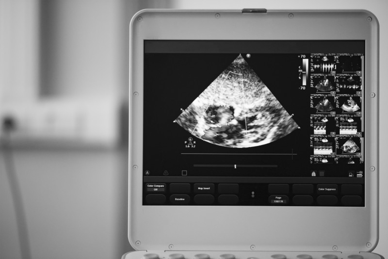 The Benefits You Can Reap From Using a Sonosite Ultrasound Machine