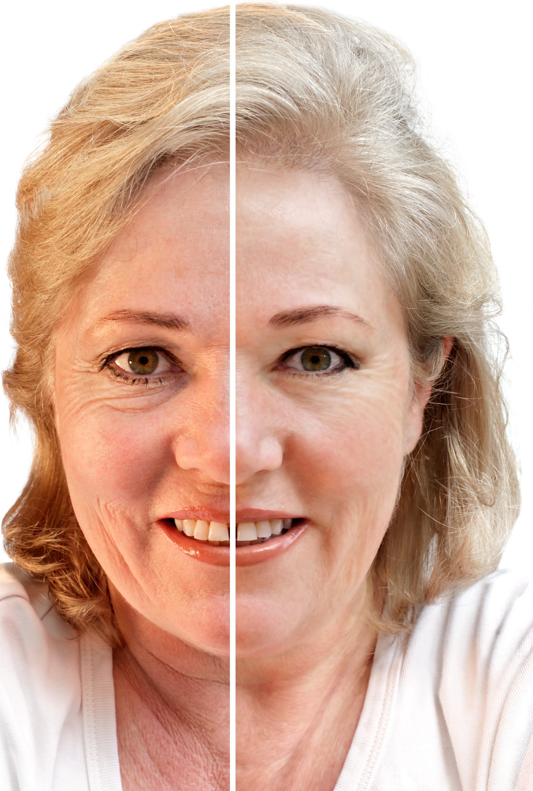 Check Your Hormonal Balance for Anti-Aging in Texas