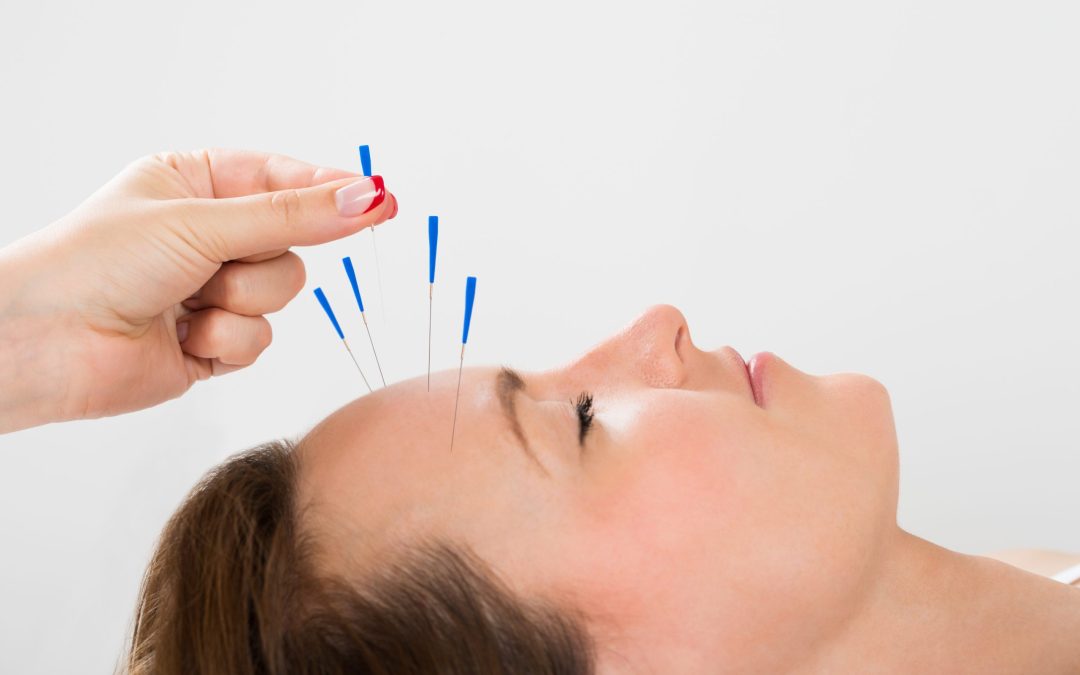 Enhancing Reproductive Health with Fertility Acupuncture in Burbank, CA