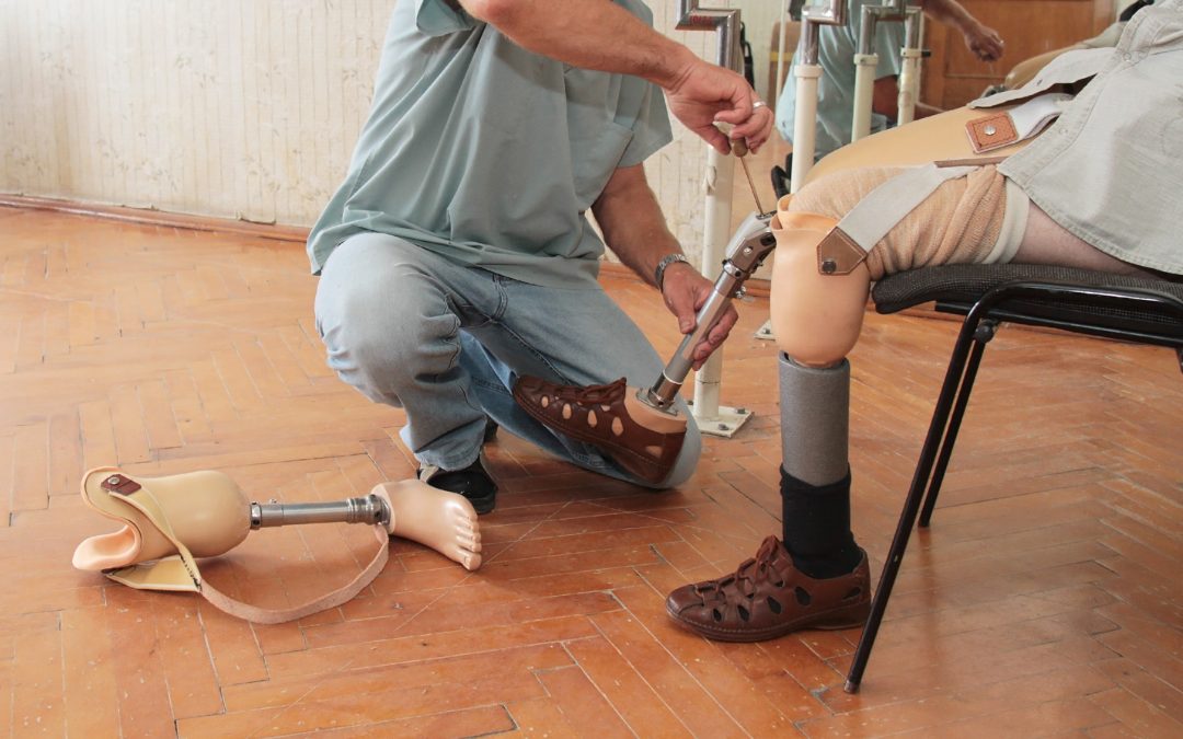 Achieving Greater Mobility with Artificial Limbs Twin Falls ID Patients Can Trust