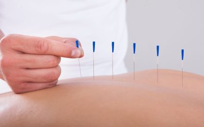 Pain Relief and Wellness Transformations Through Acupuncture in Berkeley, CA Services