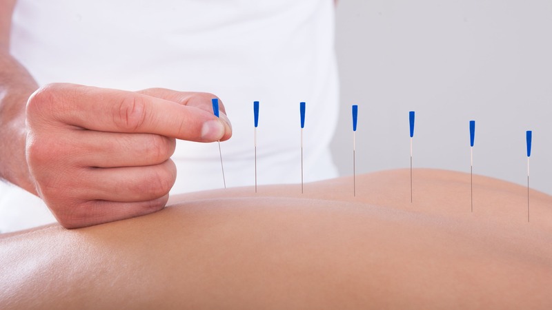 Pain Relief and Wellness Transformations Through Acupuncture in Berkeley, CA Services