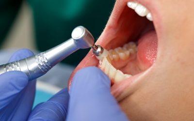 Experience gentle Dental Care in Parker, CO focused on comfort and trust