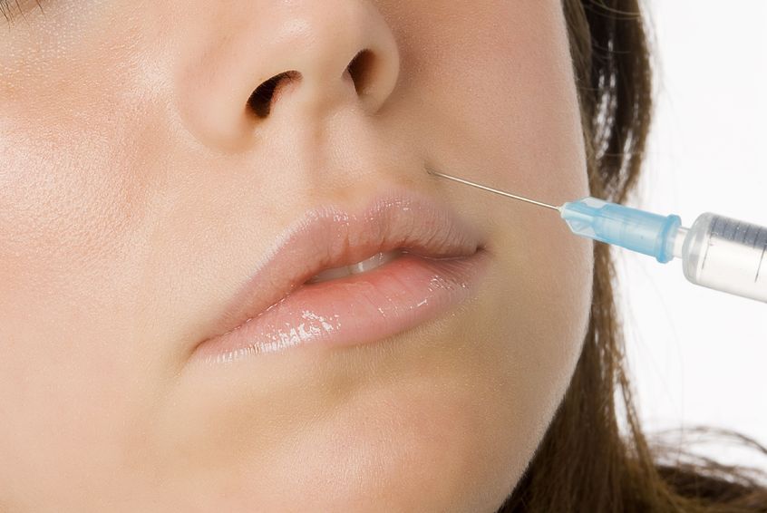 Lip Filler Benefits, Risks, and Results: A Las Vegas Guide